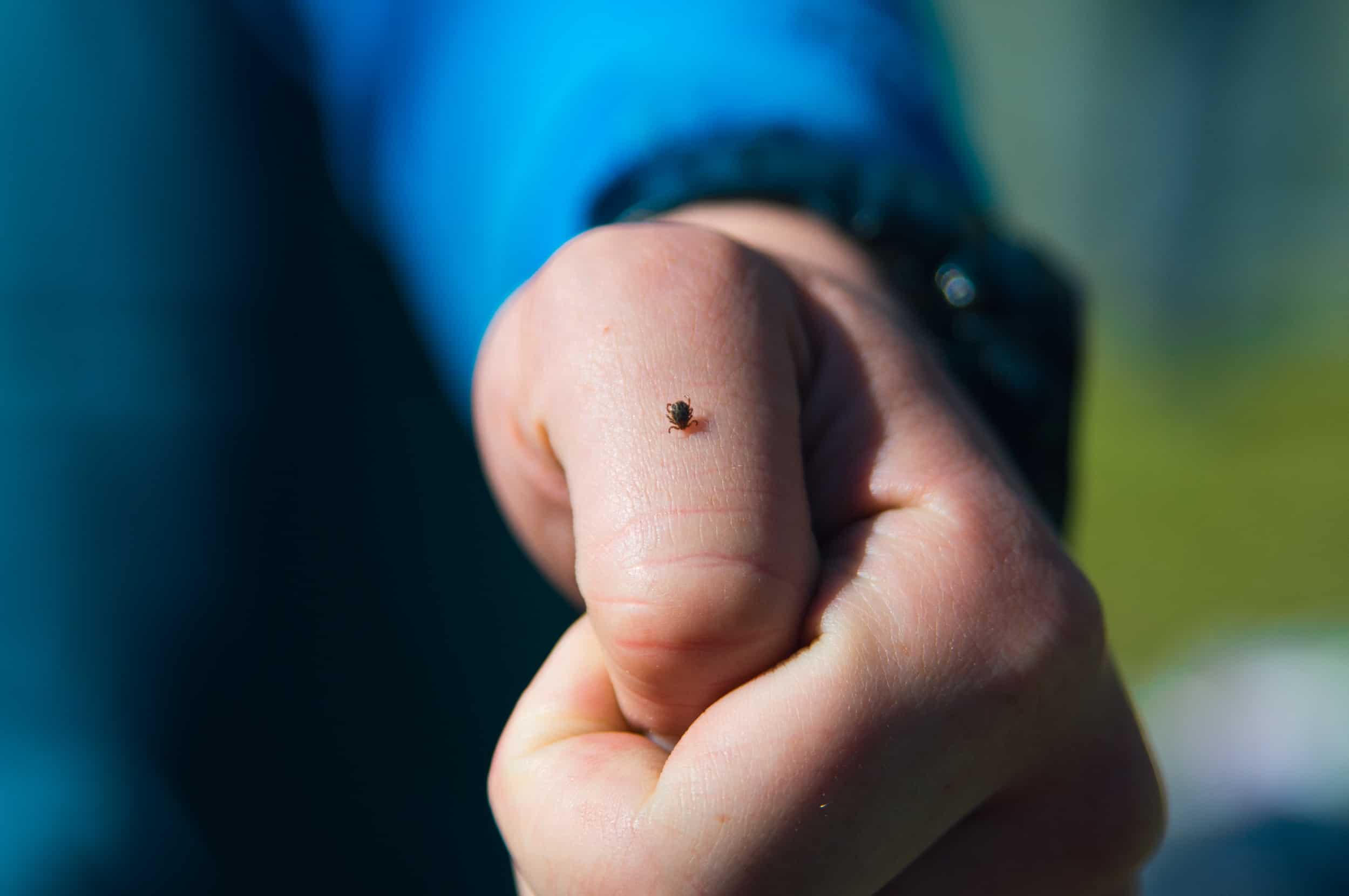 tick bite on a thumb